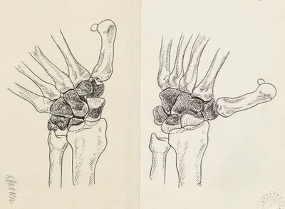 Musculoskeletal system of the hand and wrist — تصویر رکورد یوروپیانا