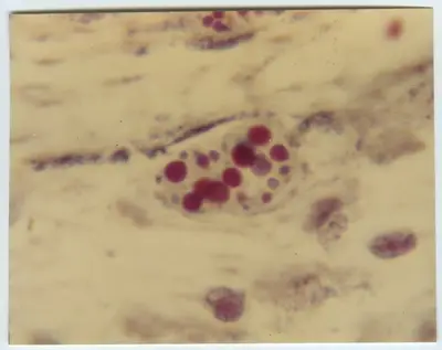 'Mikroskopbilder på amöba: :: Text på baksidan av fotot: ''Haematophagus Entamoeba histolytica in section of intestinal wall x 2000. 8515-217.'' ::  :: Ingår i serie med fotonr. 5653:1-16.' — تصویر رکورد یوروپیانا