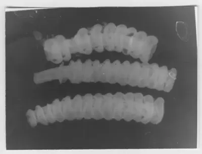 "Microscope Image of: Omphalopoma annulata (Zibrowius). : A series with a photon. 5656: 1-4. " — تصویر رکورد یوروپیانا