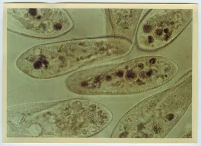 “Microscope images on amoeba: Text on the back of the photo:” Reserve copy. Paramaecium? ": Included in series with photon. 5653: 1-16. " — تصویر رکورد یوروپیانا