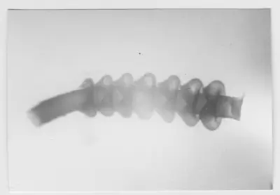 'Mikroskopbild av: :: Omphalopoma annulata (Zibrowius). ::  :: Ingår i serie med fotonr. 5656:1-4.' — تصویر رکورد یوروپیانا
