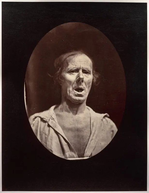 Figure 54: Abaissement volontaire de la mâchoire inférieure: mouvement inexpressif — تصویر رکورد موزهٔ هنر کلیولند (دسترسی آزاد)