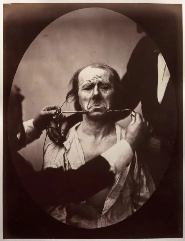 Figure 45: Contraction électrique forte des triangulaires des lèvres et des sourciliers: douleur et déspoir — تصویر رکورد موزهٔ هنر کلیولند (دسترسی آزاد)